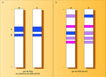 Électrophorèse - crédits : Encyclopædia Universalis France