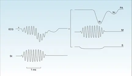 Électrocochléogramme - crédits : Encyclopædia Universalis France