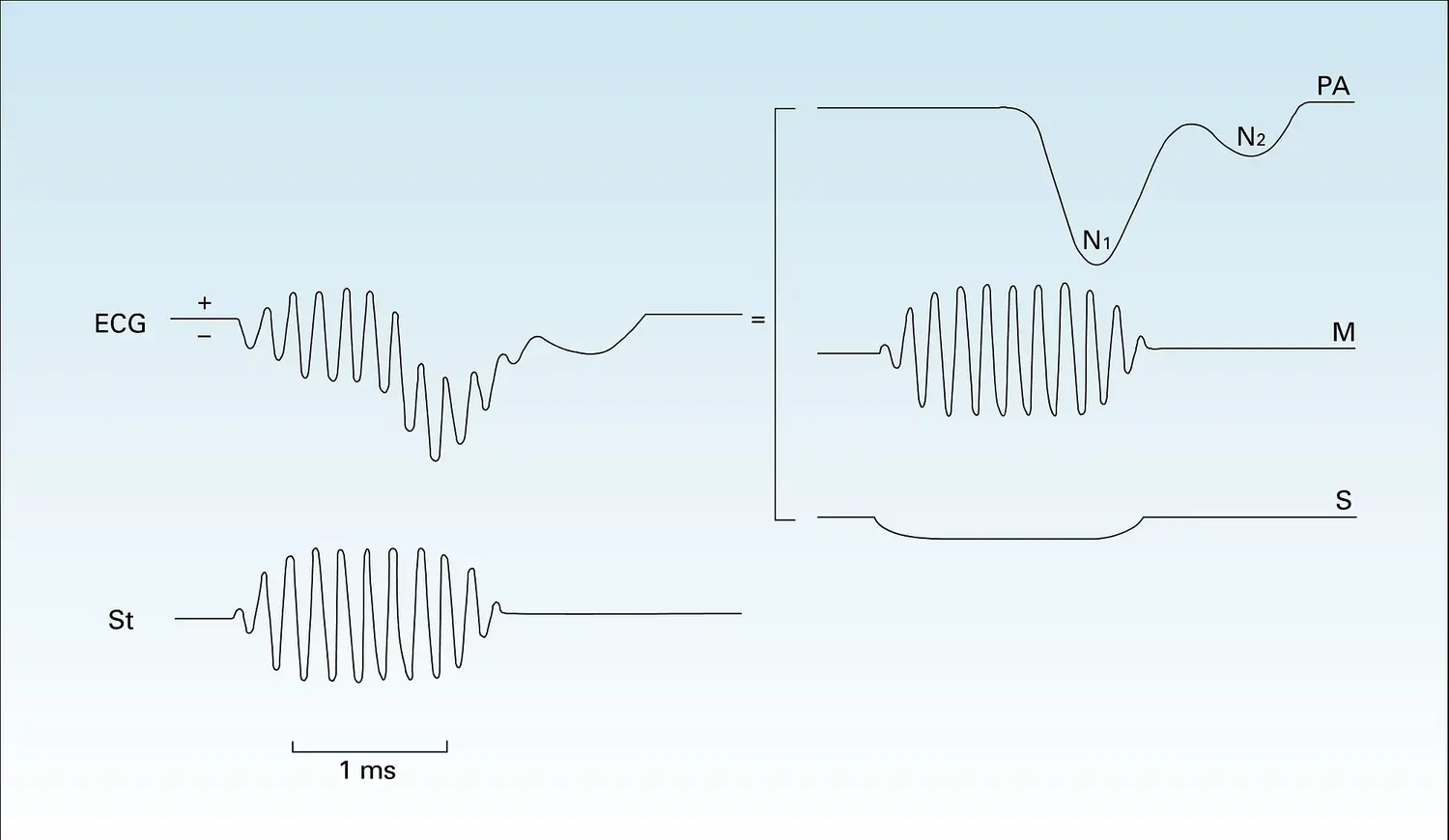 Électrocochléogramme
