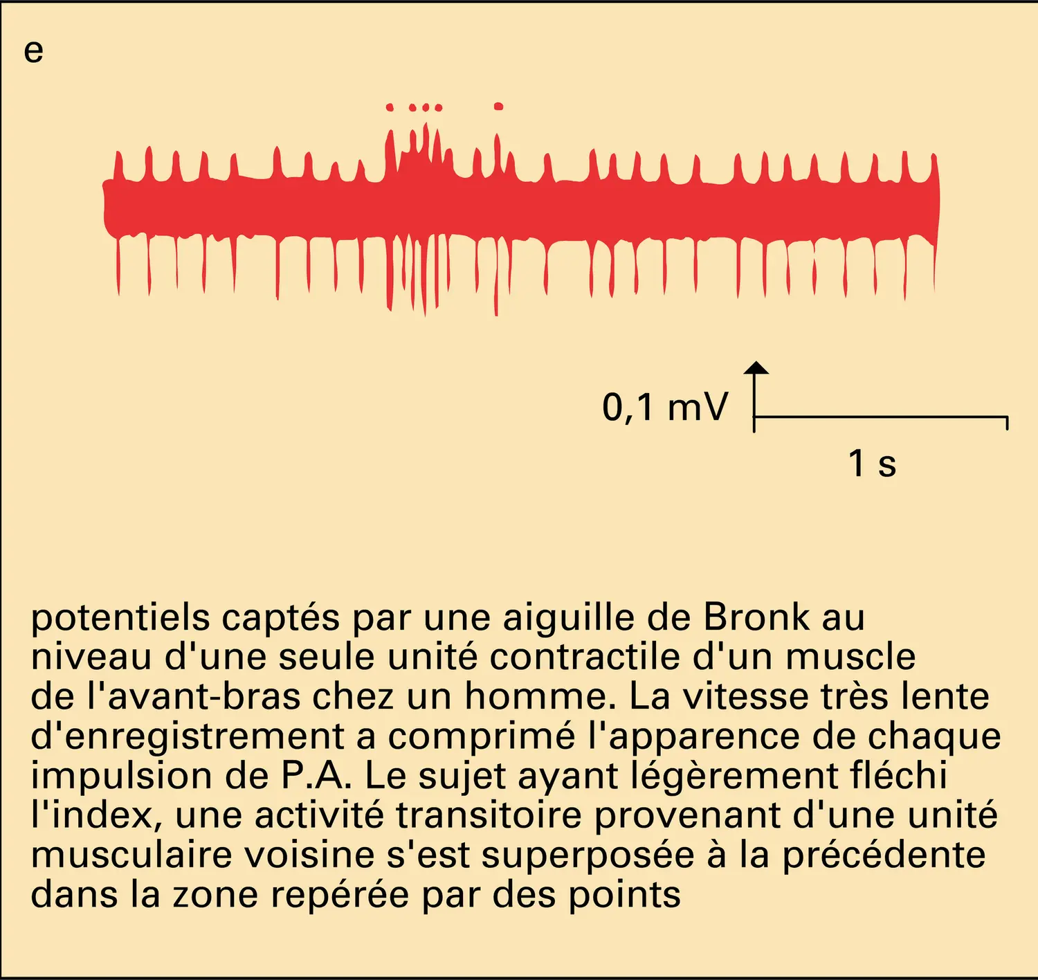 Biopotentiels - vue 5