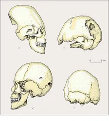 Exemples de crânes déformés (1) - crédits : Encyclopædia Universalis France