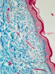 Coupe transversale de peau vue au microscope - crédits : DeAgostini/ Getty Images