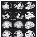 Cerveau humain et états de conscience - crédits : Encyclopædia Universalis France