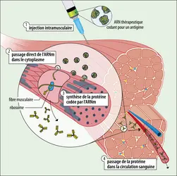 Schéma  thérapeutique utilisant un ARNm thérapeutique codant pour un anticorps - crédits : Encyclopædia Universalis France