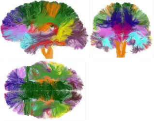 Images d’IRM de diffusion - crédits : © D. Duclap, B. Schmitt, A. Lebois, P. Guevara, D. Le Bihan, J.-F. Mangin, C. Poupon/ CEA-NeuroSpin (source « Clefs CEA » n°62)