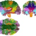 Images d’IRM de diffusion - crédits : © D. Duclap, B. Schmitt, A. Lebois, P. Guevara, D. Le Bihan, J.-F. Mangin, C. Poupon/ CEA-NeuroSpin (source « Clefs CEA » n°62)