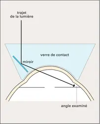 Gonioscopie - crédits : Encyclopædia Universalis France