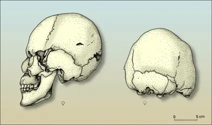 Exemples de crânes déformés (2) - crédits : Encyclopædia Universalis France
