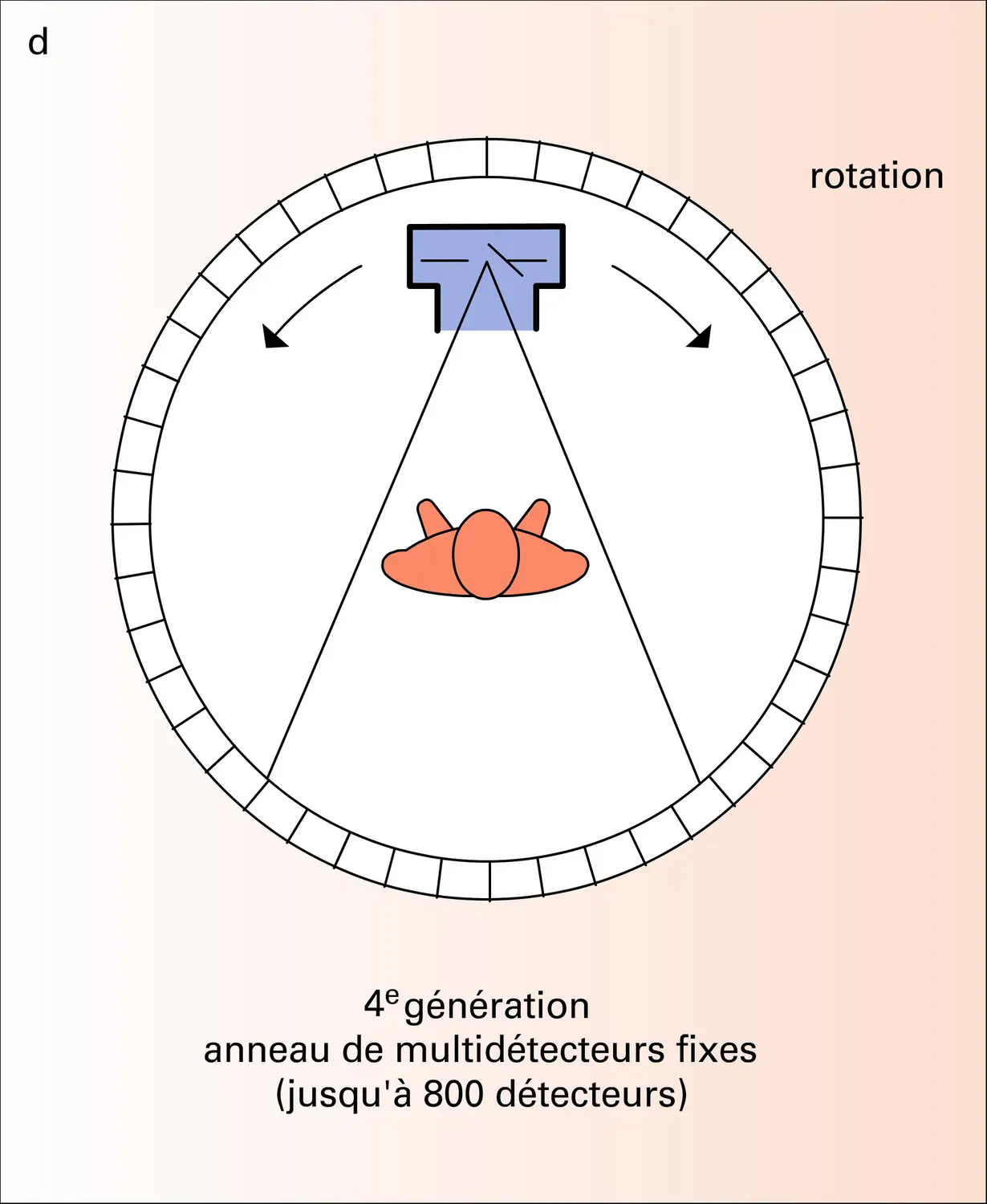 Tomodensitométrie : différents types de systèmes - vue 4