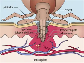 Processus d’alimentation d’une tique - crédits : Encyclopædia Universalis France