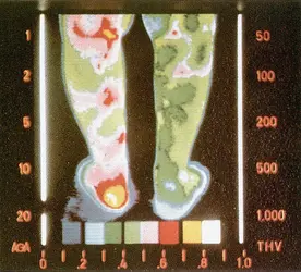 Image thermographique - crédits : M. Laval-Jeantet