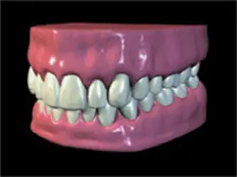 Dentisterie Restauratrice, Prothétique et Cosmétique