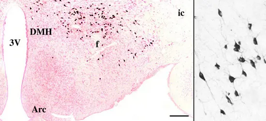 Sommeil-rêve-éveil : stimulation de l'éveil - crédits : CNRS, Université Claude Bernard Lyon I