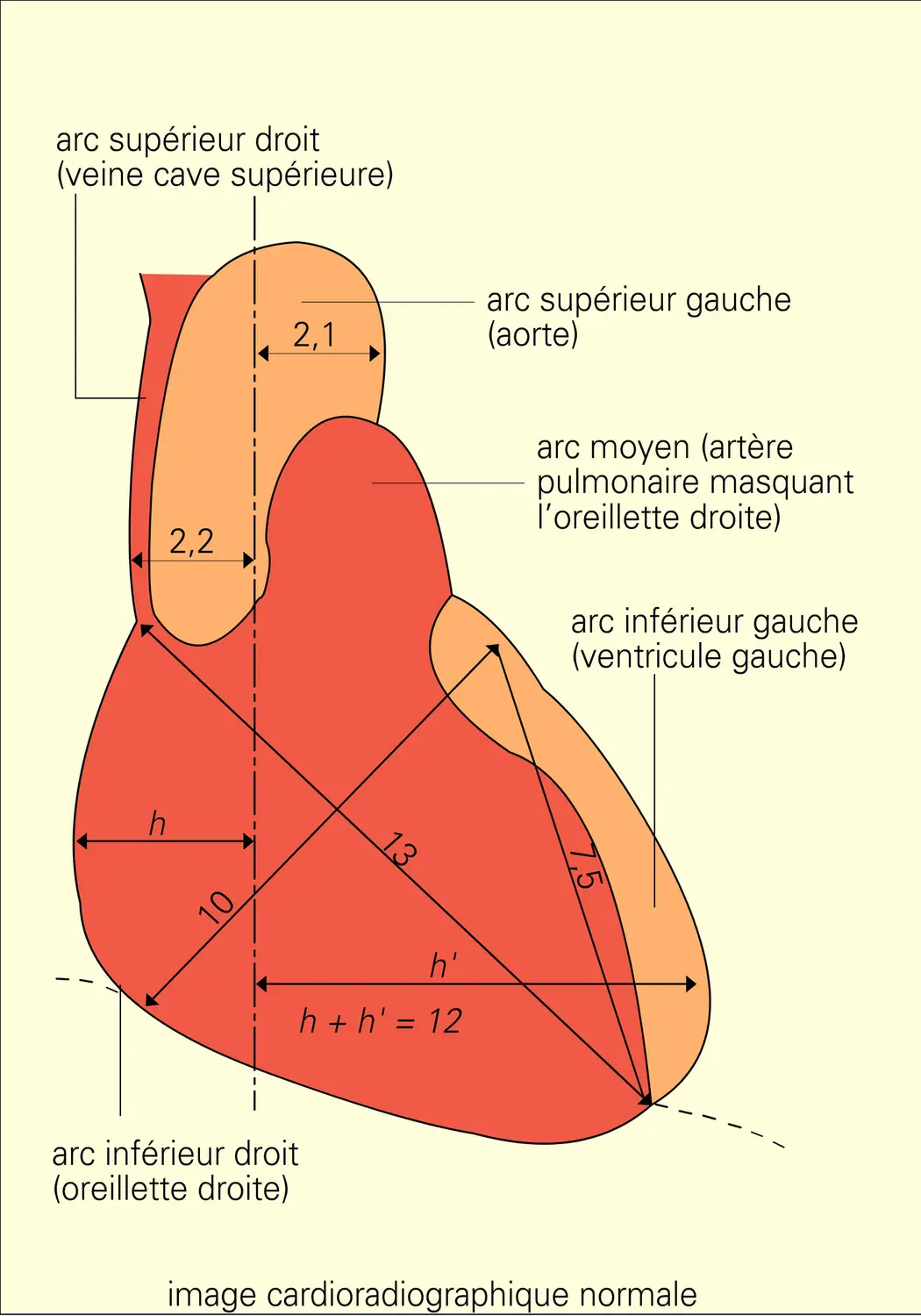 Repères cardiologiques - vue 2