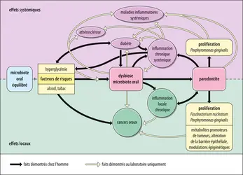 Déséquilibre du microbiote buccal (dysbiose) et maladies - crédits : Encyclopædia Universalis France