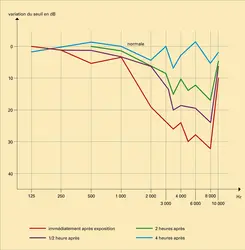 Audition : fatigue auditive - crédits : Encyclopædia Universalis France