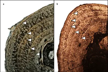 Squelettochronologie - crédits : (a) © 2014 Woodward et al. (CC BY 4.0) ; (b) Anusuya Chinsamy-Turan/ University of Cape-Town