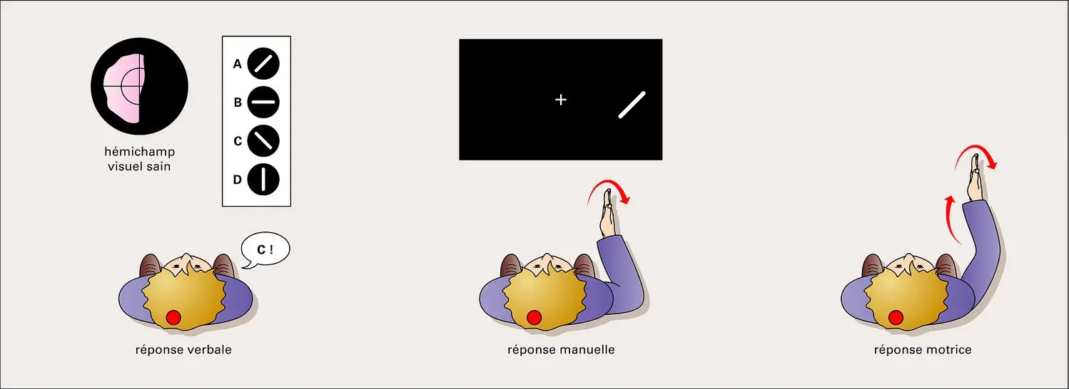 Perception visuelle : expérience de Perenin et Jeannerod