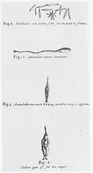 Métamorphose d’un animalcule spermatique, F. de Plantade - crédits : Wellcome Collection ; CC-BY 4.0