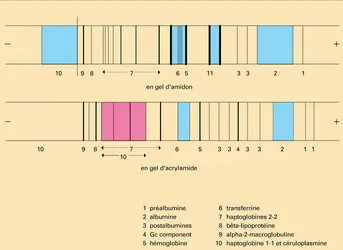 Électrophorèse d'un sérum humain - crédits : Encyclopædia Universalis France