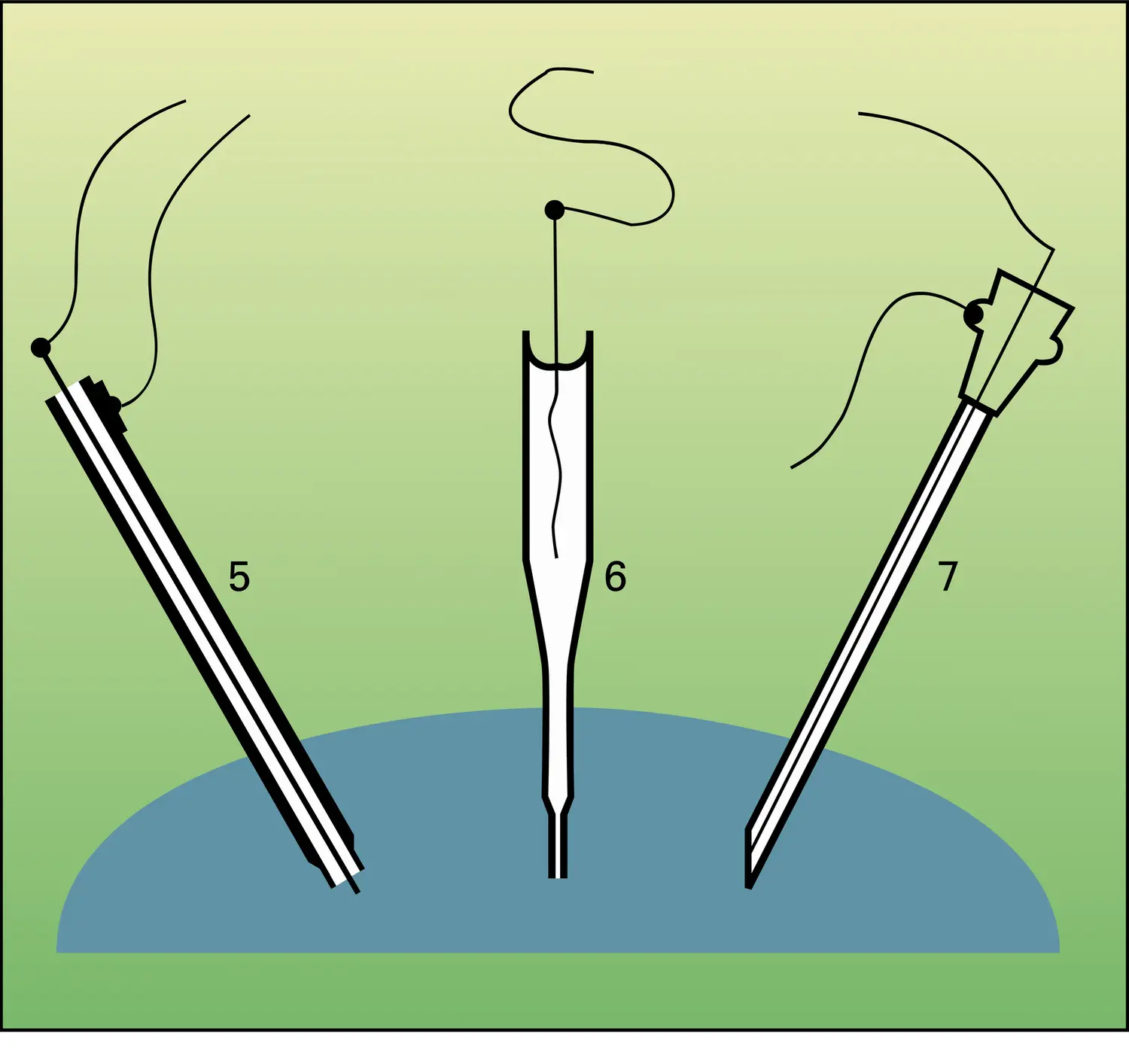 Électrodes - vue 3