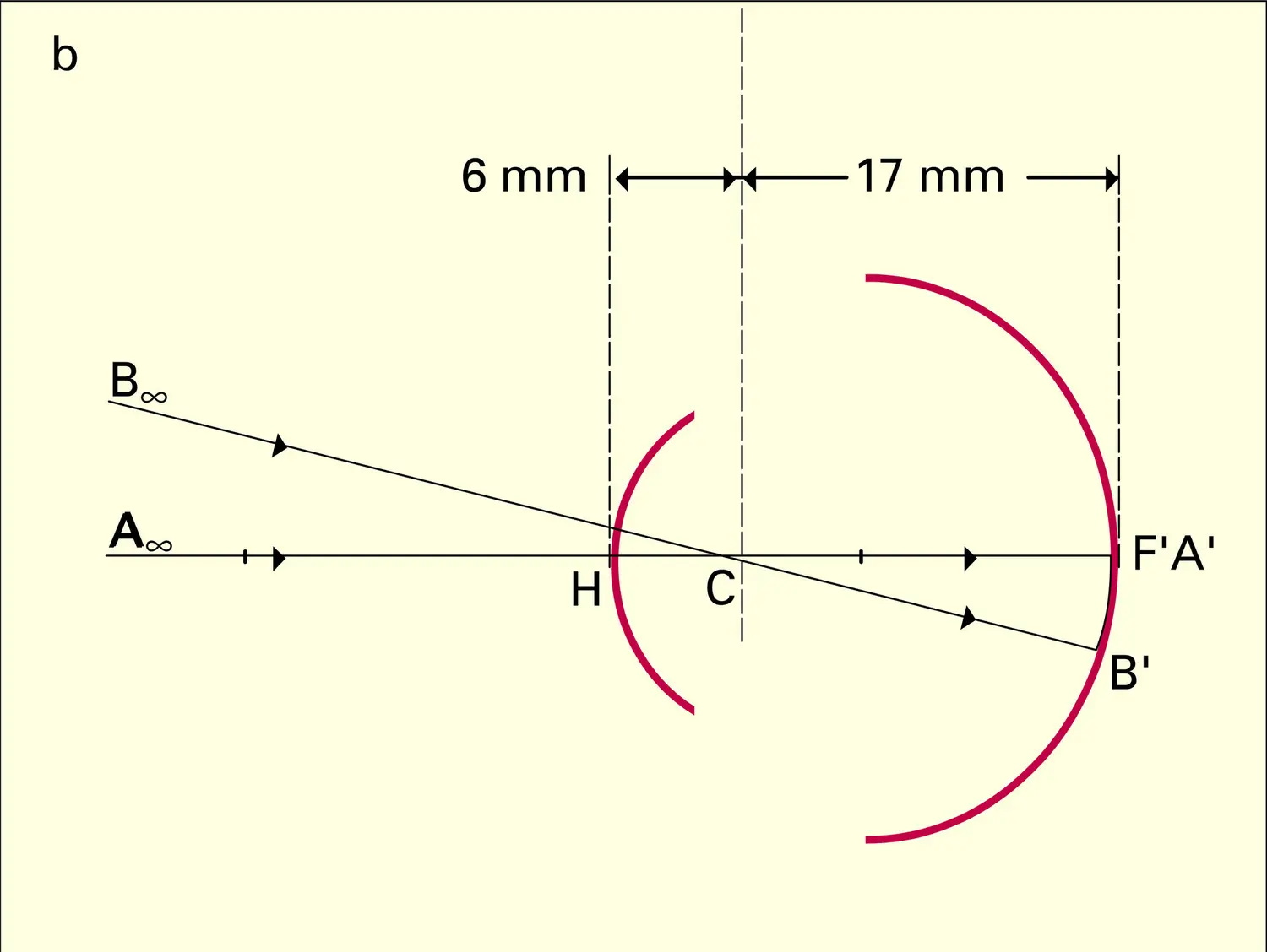 Formation des images : bonne et mauvaise vues - vue 2