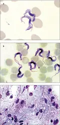 Les trois parasites flagellés cibles de l’inhibiteur de protéasome - crédits : Blaine Mathison/ CDC ; F. Brenière ; AKG-images/Science Photo Library