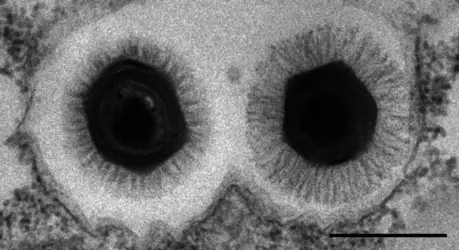 Mimivirus et Megavirus - crédits : IGS, CNRS UMR 7256