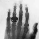 Radiographie prise par Wilhelm Röntgen - crédits : Hulton Archive/ Getty Images