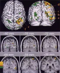 Vision humaine : activation du cortex - crédits : 1999 with permission from Elsevier