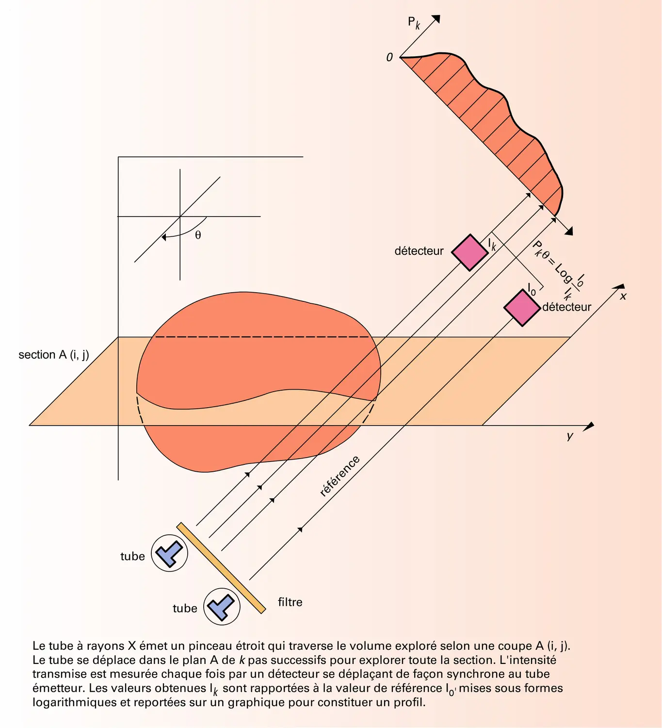 Tomodensitométrie : projection et balayage - vue 1