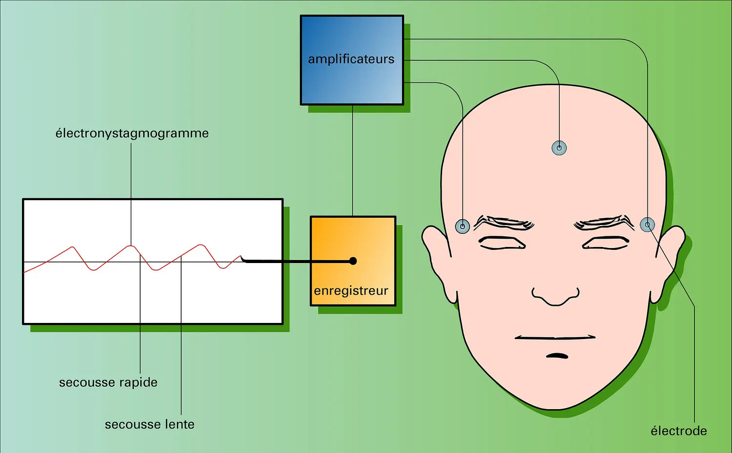 Électronystagmographie