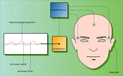 Électronystagmographie - crédits : Encyclopædia Universalis France