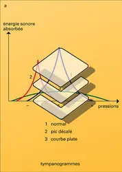 Impédancemétrie et ondes de potentiels évoqués - crédits : Encyclopædia Universalis France