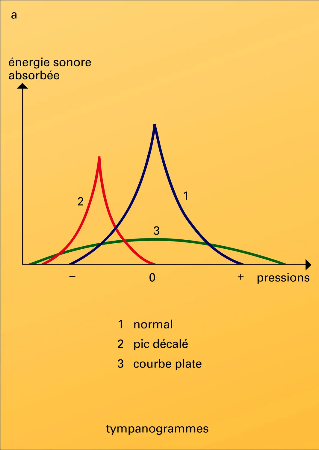 Impédancemétrie et ondes de potentiels évoqués - vue 1