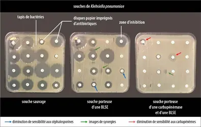 Antibiogrammes de <em>Klebsiella pneumoniae </em>sensibles et résistants - crédits : Sylvain Meyer