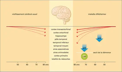 Neuro-vieillissement et maladie d'Alzheimer - crédits : Encyclopædia Universalis France