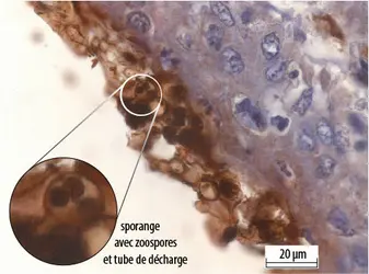 Coupe d’une peau d’amphibien infectée par le champignon <em>Batrachochytrium dendrobatidis</em> - crédits : Frank Pasmans/ Wildlife Health Ghent, UGent