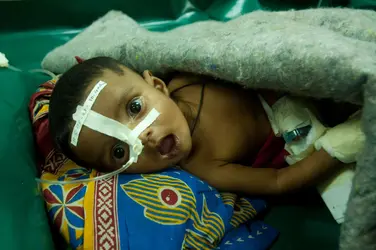 Enfant atteint d’une maladie diarrhéique - crédits : Muhammad Mostafigur Rahman/ Alamy/ Hemis.fr