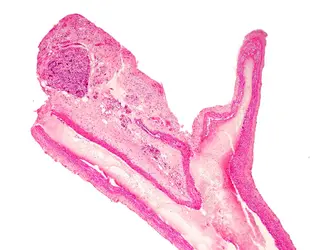 Coupe histologique d’un glomus carotidien - crédits : Jose Calvo/ Science Photo Library