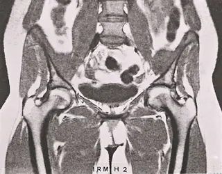 Imagerie médicale : les contrastes en I.R.M. - crédits : Collection Guy Pallardy