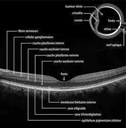 Structure fine de la rétine en OCT au niveau de la fovea - crédits : photo : Paul Whitten/ Science Photo Library ; textes : EUF