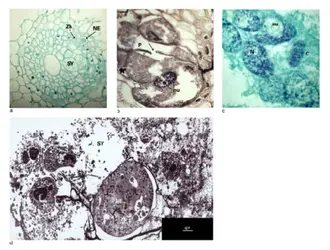 Galle de nématodes - crédits : Encyclopædia Universalis France