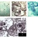 Galle de nématodes - crédits : Encyclopædia Universalis France