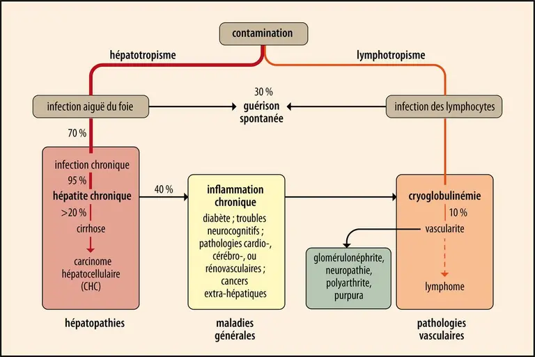 Histoire naturelle de l’hépatite C