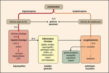 Histoire naturelle de l’hépatite C - crédits : Encyclopædia Universalis France