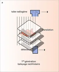 Tomodensitométrie : différents types de systèmes - crédits : Encyclopædia Universalis France