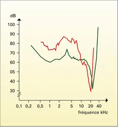 Vibrations de la membrane basilaire et réponse nerveuse - crédits : Encyclopædia Universalis France