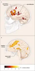 Activation cérébrale dans une situation de dénomination de mot et dans une tache de sélection de langue - crédits : Encyclopædia Universalis France