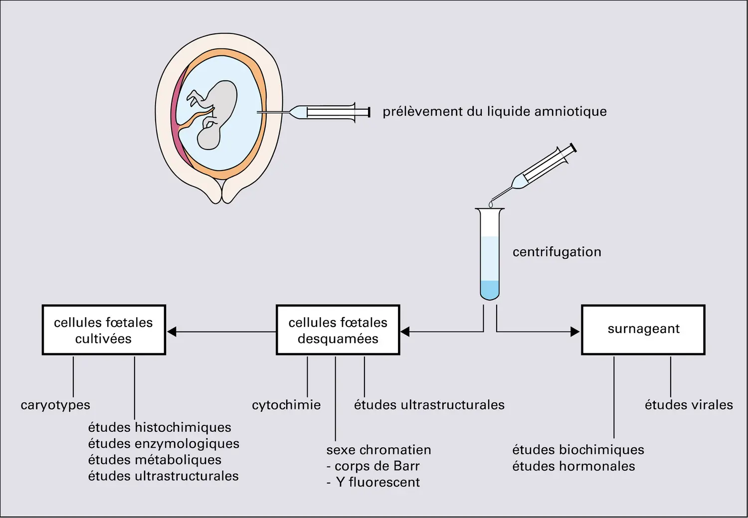 Amniocentèse